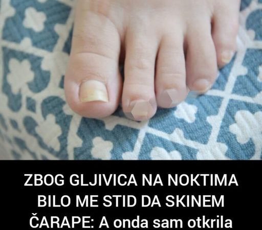 Pogledajte kako se riješiti gljivica na nogama