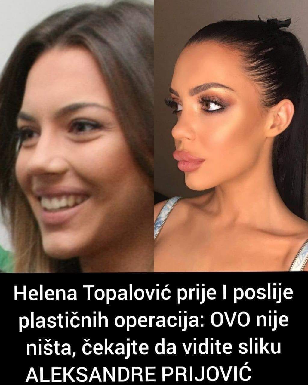 Pogledajte kako izgleda Topalovkova kćerka prije operacija, kao i neke druge poznate ličnosti