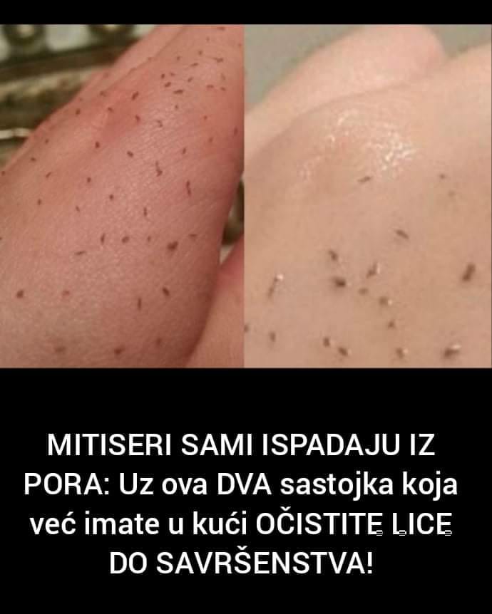 Pogledajte uz koja dva sastojka možete očistiti lice do savršenstva