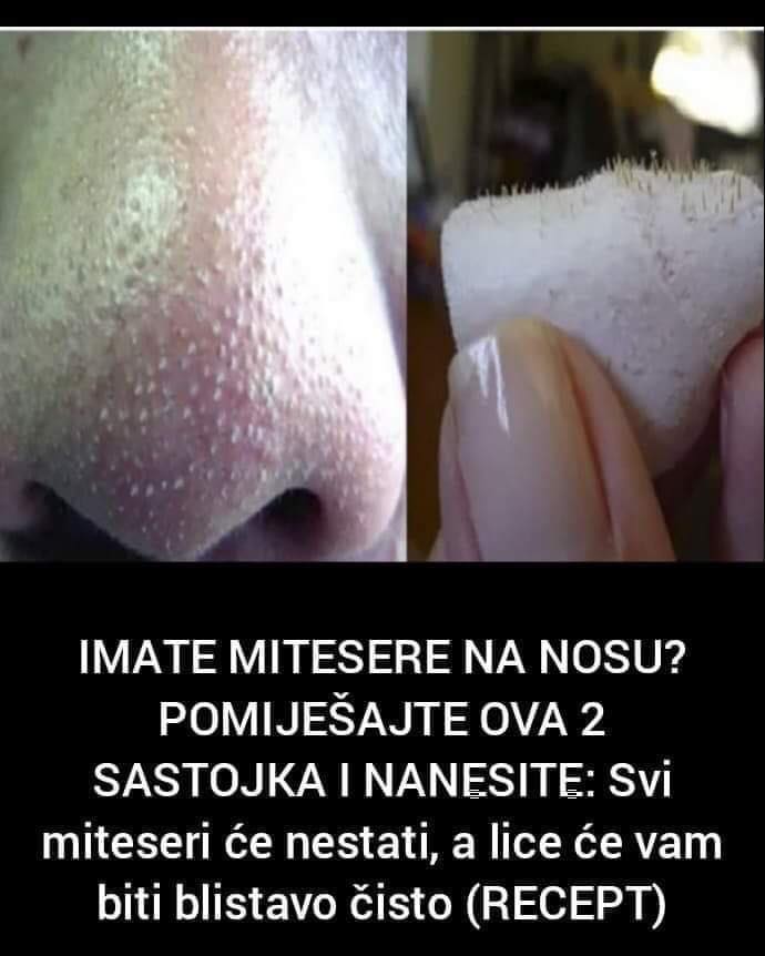 Pogledajte kako se riješiti mitisera pomoću samo ova dva satojka