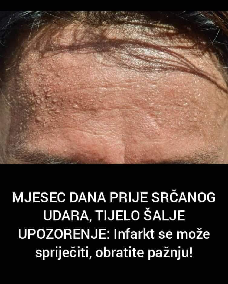 8 znakova da vam prijeti infarkt, mjesec dana prije toga tijelo šalje upozorenje