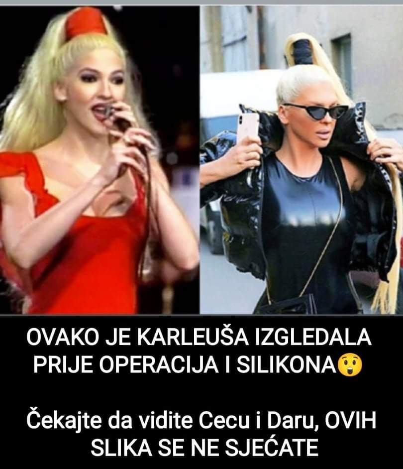 Izgled Karleuše prije svih njenih operacija