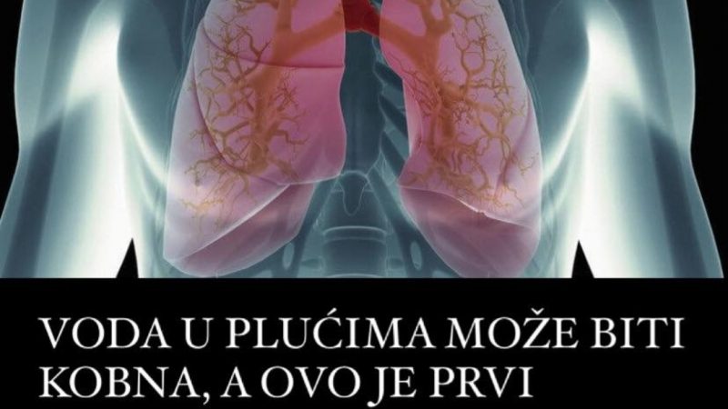 Pogledajte koji je to prvi simptom koji ukazuje da imate vodu u plućima