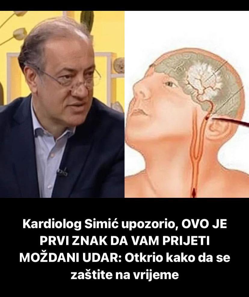 Pogledajte koji su prvi znaci moždanog udara