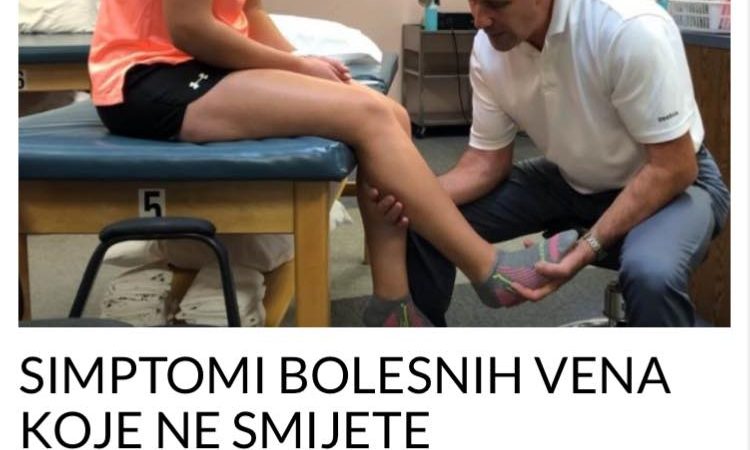 Pogledajte koji su simptomi bolesnih vena