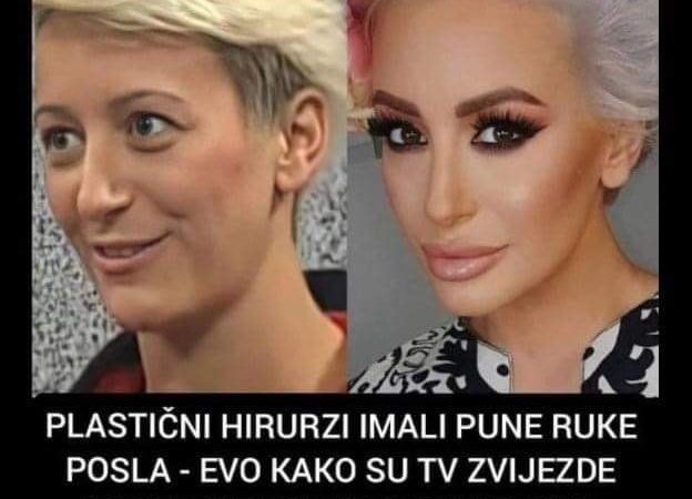 Pogledajte kako posle operacija izgledaju neke poznate licnosti