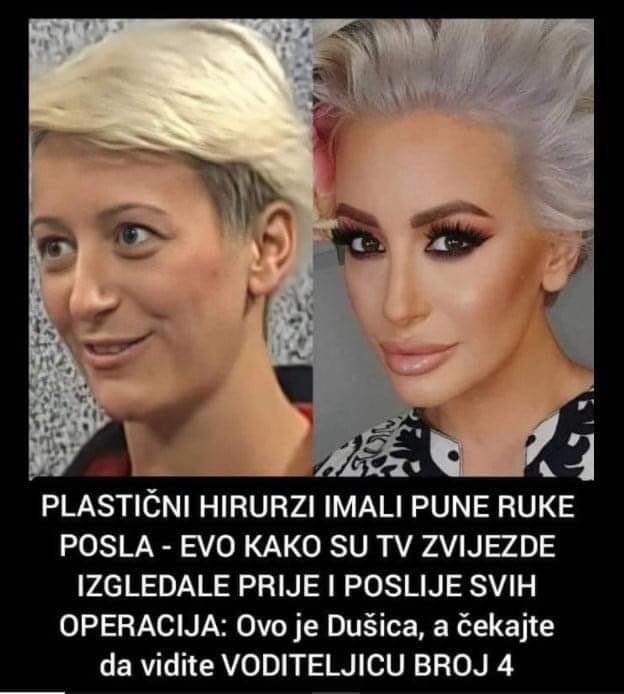 Pogledajte kako posle operacija izgledaju neke poznate licnosti