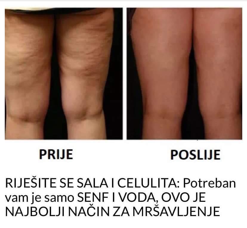 POGLEDAJTE I RIJESITE SE BRZO SALA I CELULITA