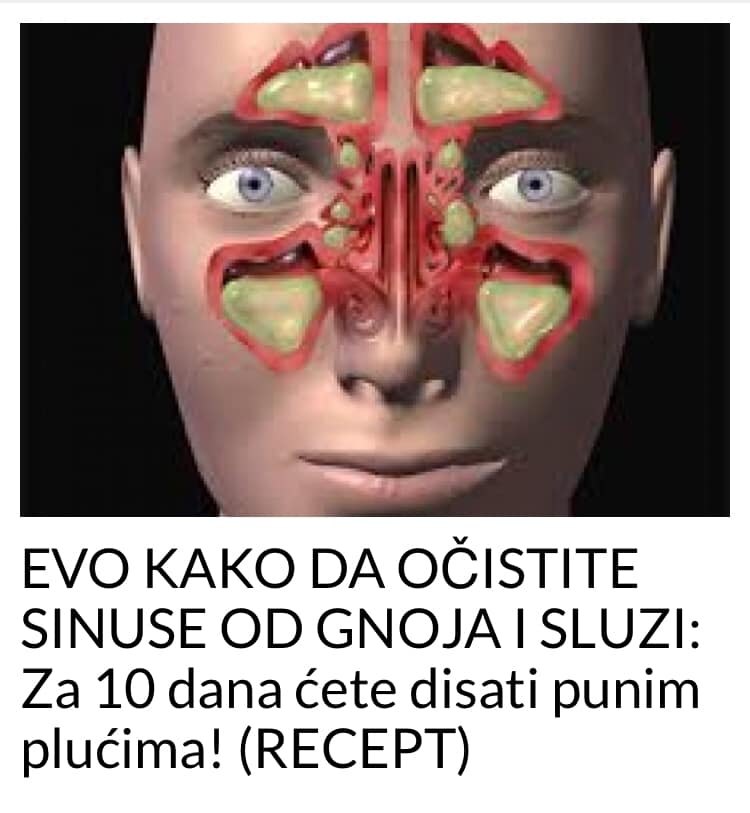 POGLEDAJTE KAKO DA OČISTITE SINUSE OD GNOJA I SLUZI