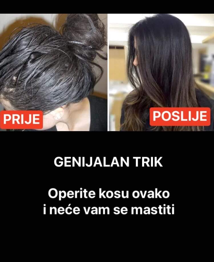 POGLEDAJTE TRIK OD KOJEG VISE NECETE IMAT PROBLEMA SA MASNOM KOSOM