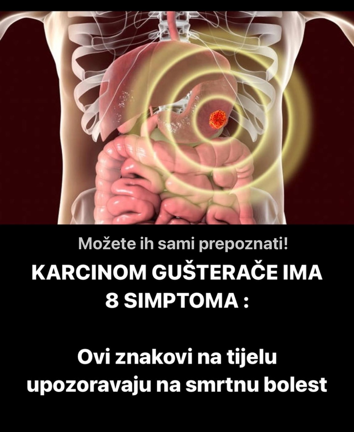 POGLEDAJTE 8 SIMPTOMA KARCINOMA GUŠTERAČE