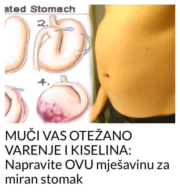 POGLEDAJTE STA TREBATE KORISTITI DA VAS NE MUCI KISELINA