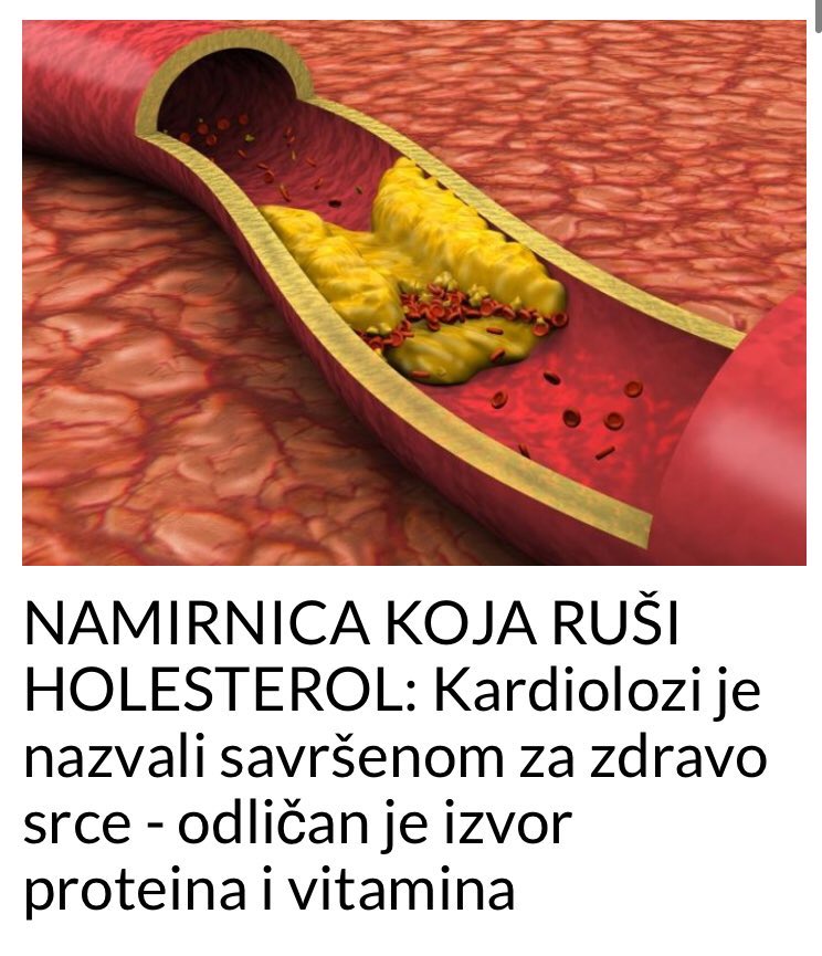 OVA NAMIRNICA RUŠI HOLESTEROL