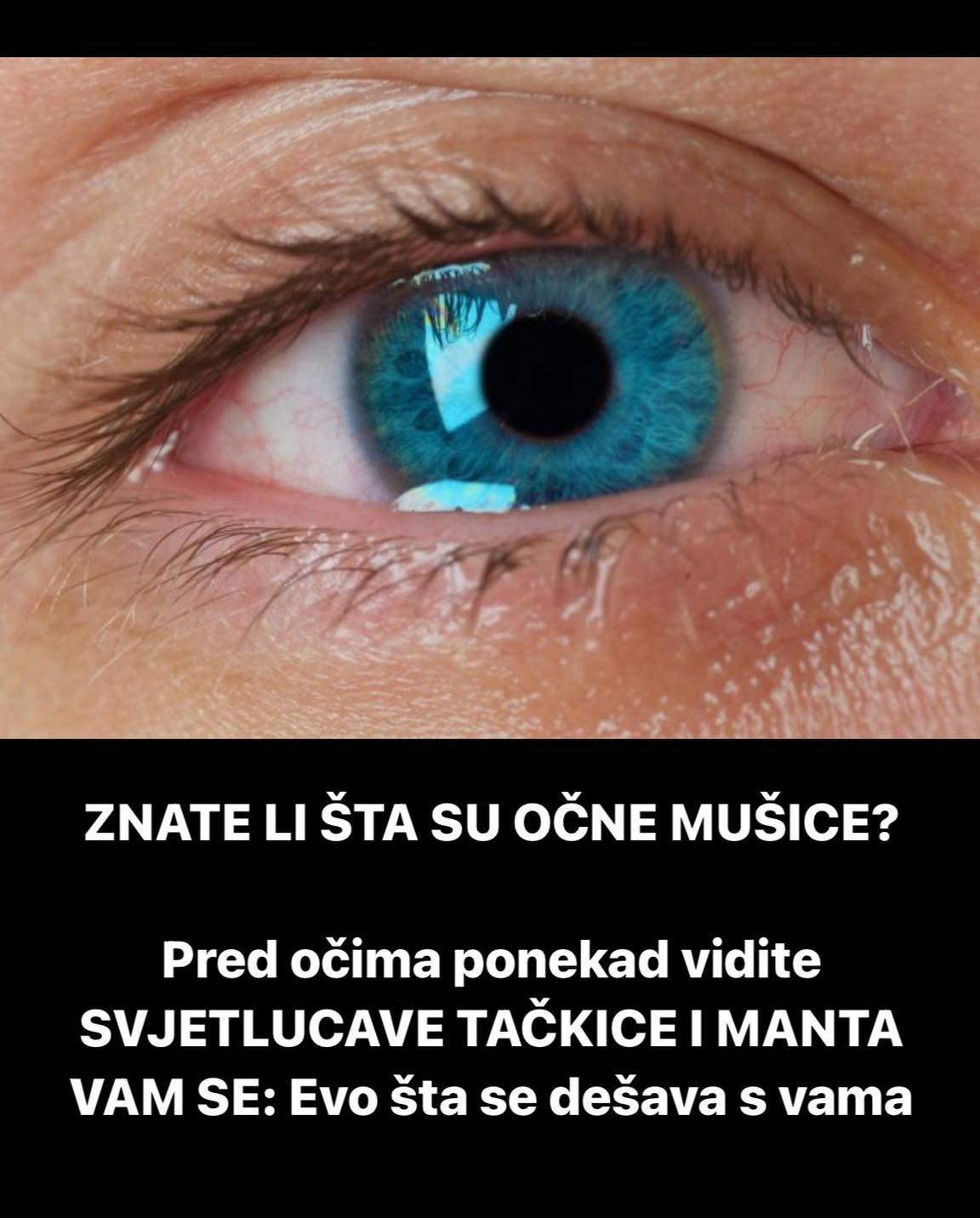 EVO STA ZNACI KADA VAM SED PRED OCIMA POJAVE SVJETLUCAVE TACKICE I MANTA VAM SE